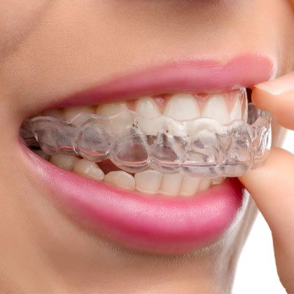 invisalign trays