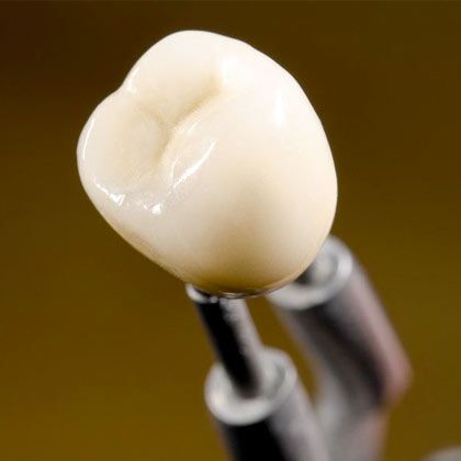 dental crown